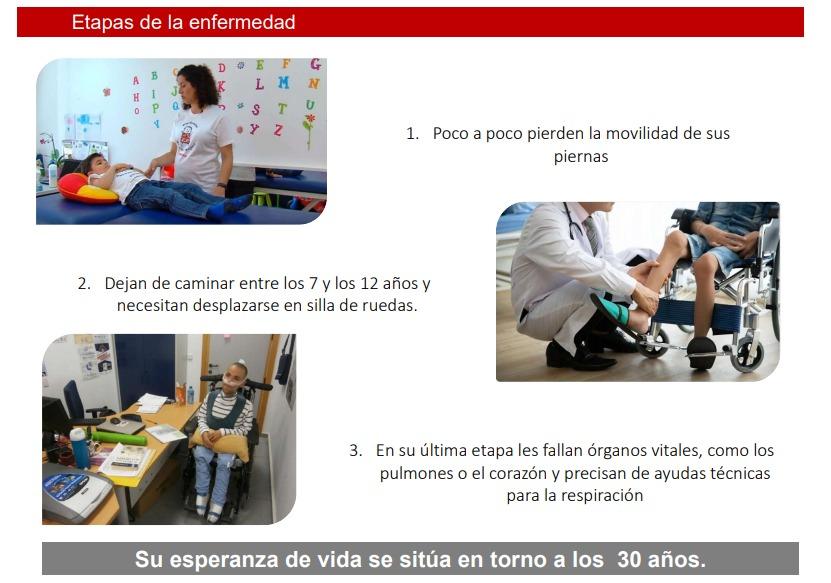 Proyecto SARA, hacer realidad ensayos clínicos en Duchenne